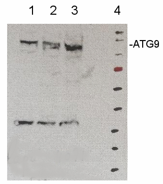 Western blot using anti-ATG9 antibodies